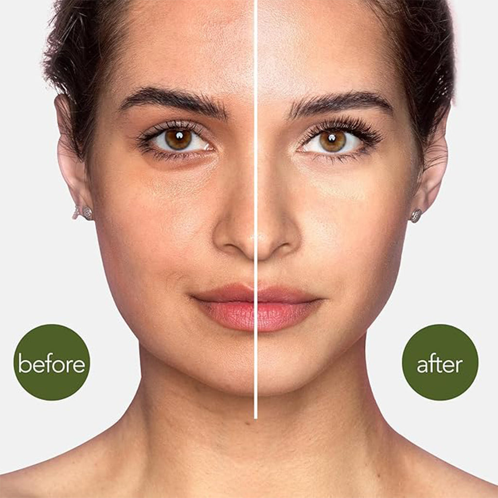 Aardlig FlexSculpt Set before and after skin care results showcasing smoother, refreshed complexion.