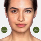 Aardlig FlexSculpt Set before and after results showcasing improved skin texture and appearance.